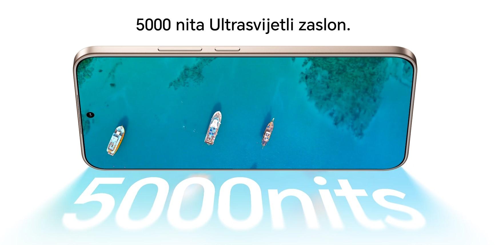 Honor 400 dodatna slika